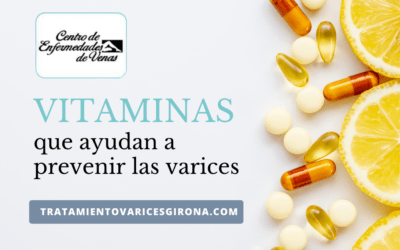 Vitaminas que ayudan a prevenir las varices