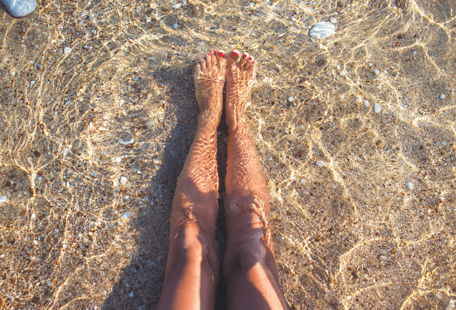 ¿Por qué las varices empeoran en verano?