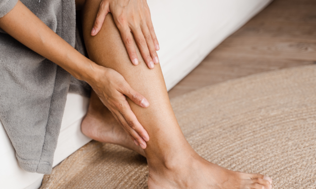 Tratamiento no invasivo para varices y arañas vasculares